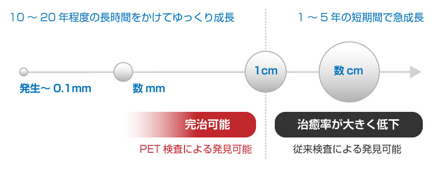 がんの発育過程の図