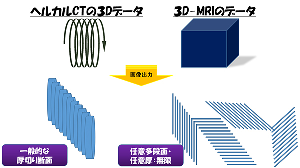 ヘルカルCTの３Dデータ・３D-MRIのデータの画像出力時のイメージ画像