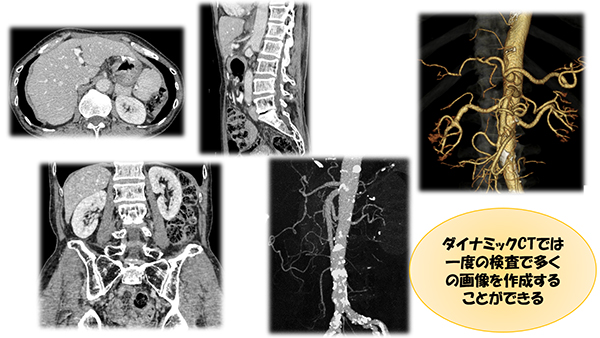 ダイナミックCTでは一度の検査で多くの画像を作成することができる